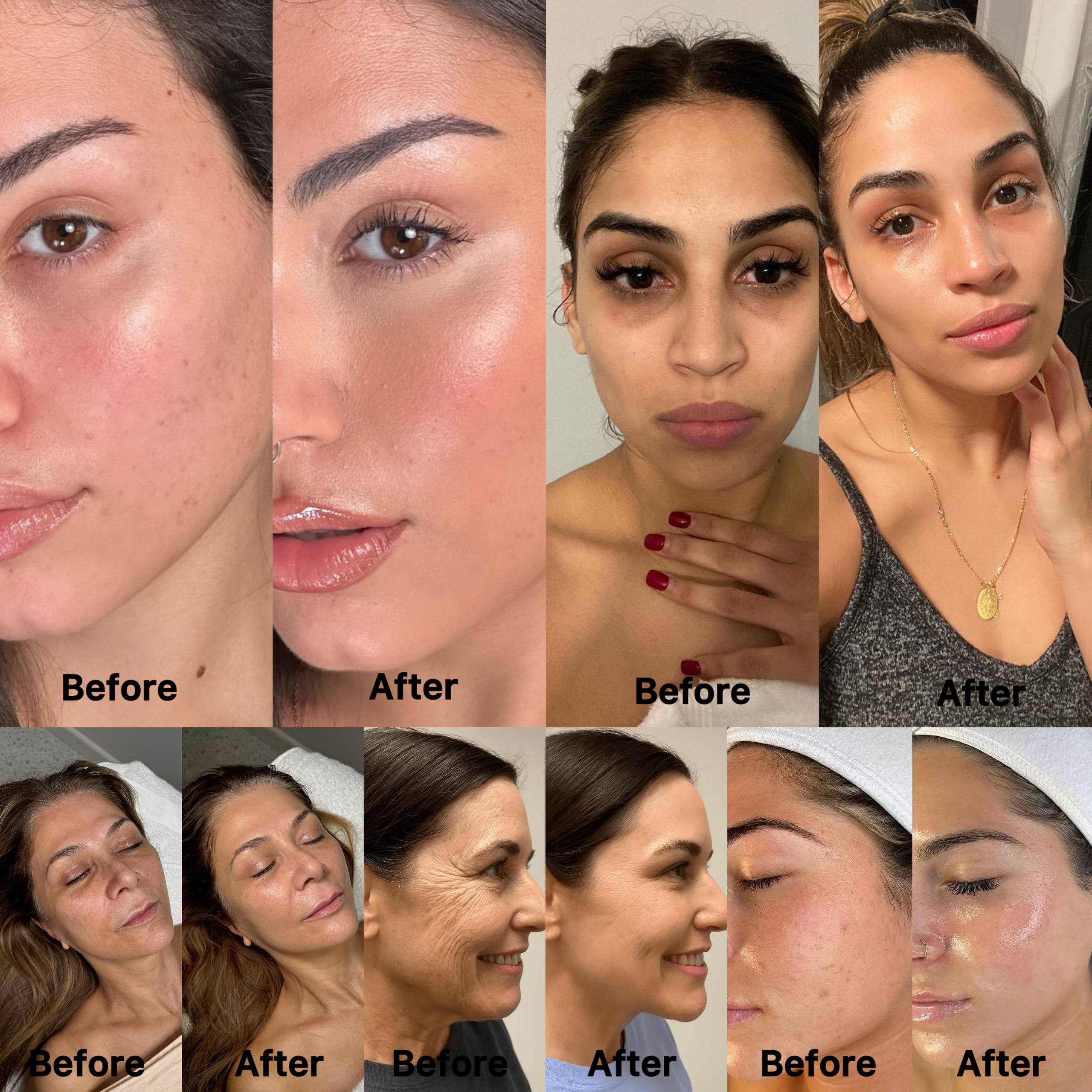 Face Led Pro Before and After Results